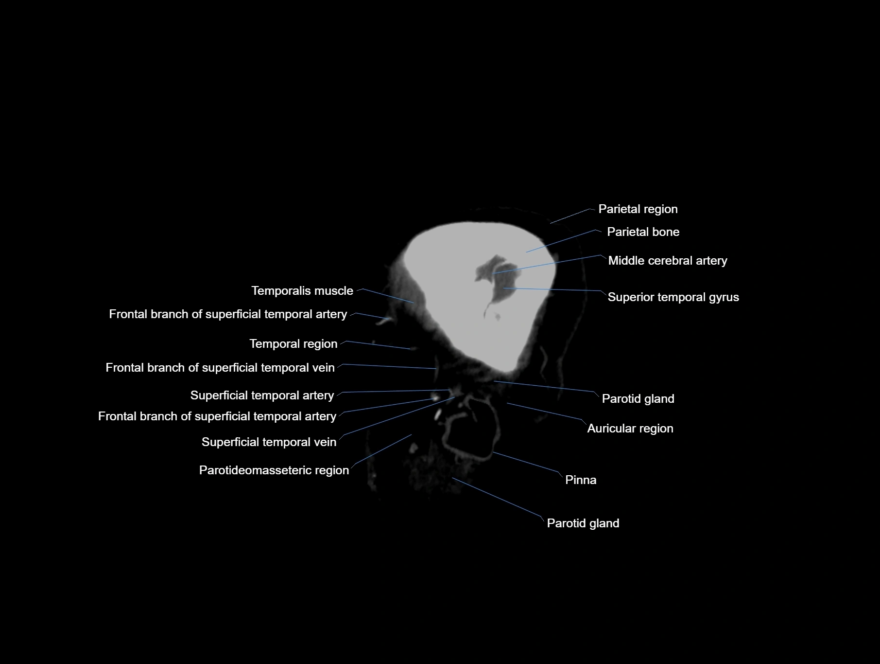 CT scan brain sagittal cross sectional anatomy image-img-00001-00005.webp